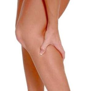 Veins Varicose ar na cosa